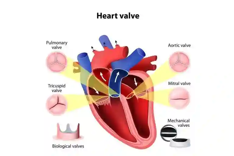 Valve Replacement Surgery in Hyderabad