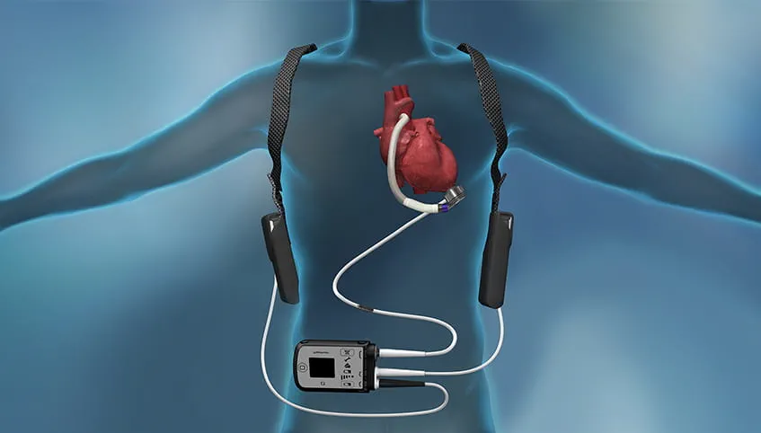 Cardiac surgeon near Gachibowli